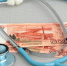 Более 8 тысяч медиков в ЧР получают специальные социальные выплаты - ИА Грозный-информ